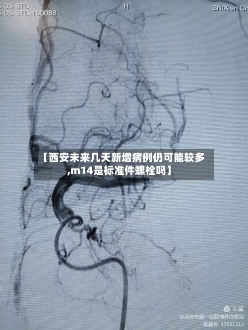 【西安未来几天新增病例仍可能较多,m14是标准件螺栓吗】-第3张图片