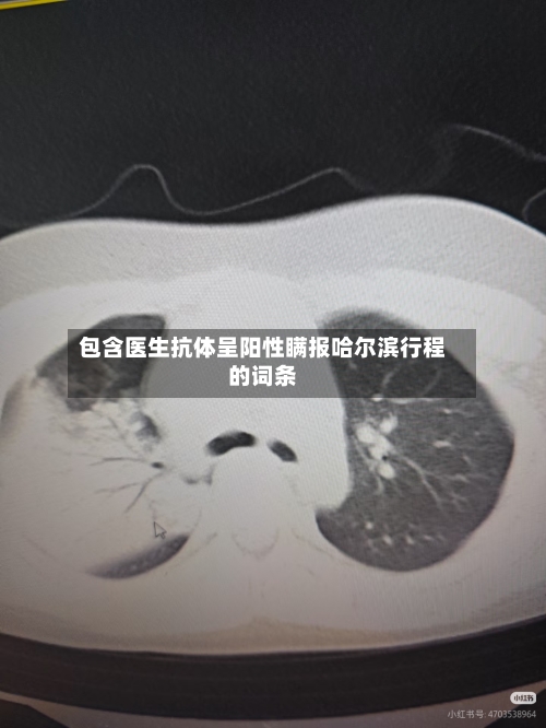 包含医生抗体呈阳性瞒报哈尔滨行程的词条-第2张图片